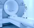 MRI scan: Brain scan
