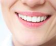 Tooth whitening - BrightSmile