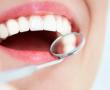 Tooth extraction - wisdom tooth