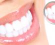 Dentures - Full acrylic